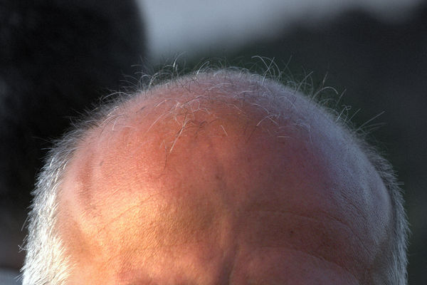 Japanese Hotels Offering Discounts to Balding Guests