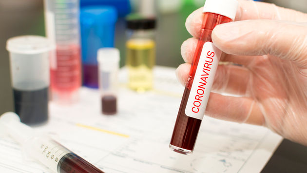 Close-up of blood in a test tube amid the coronavirus outbreak