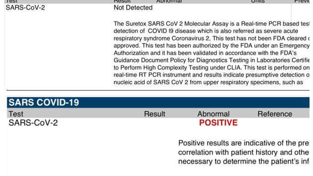Example of COVID-19 test results